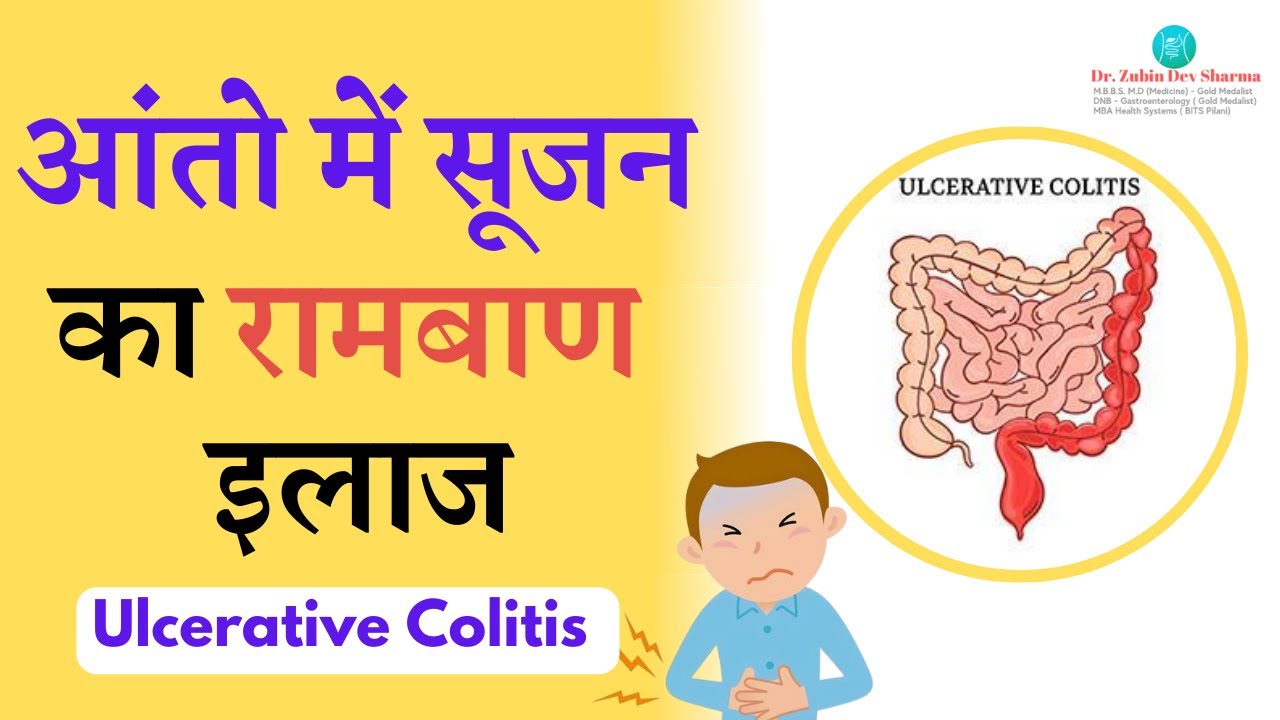 आंतो में सूजन, ( Ulcerative Colitis ) Causes, Symptoms, Diagnosis and Treatment #ulcerativecolitis